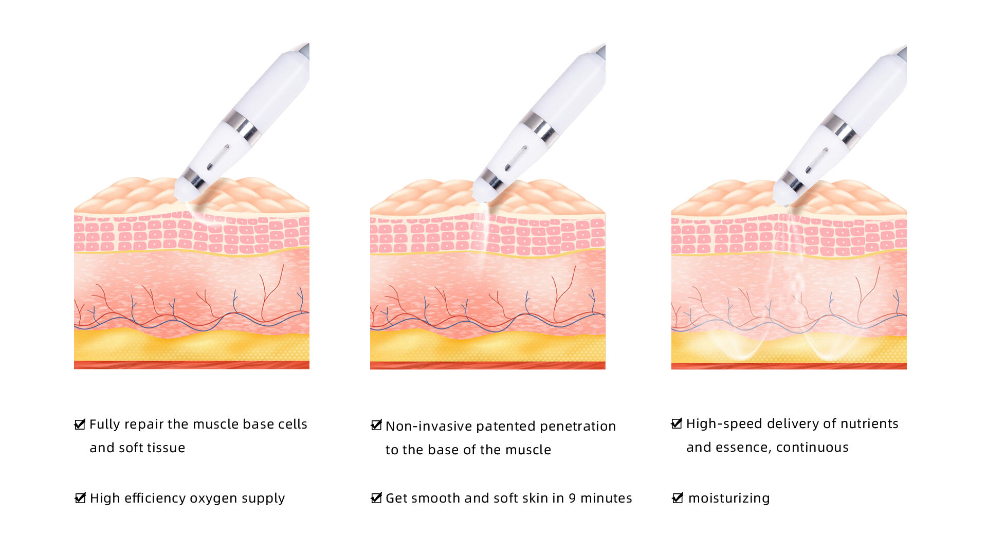 EFFECT OF ACIACIA