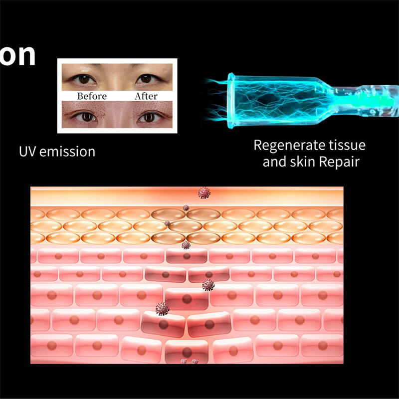 Sådan fungerer koldplasma-apparater for følsom hud: En mild tilgang til fornyelse