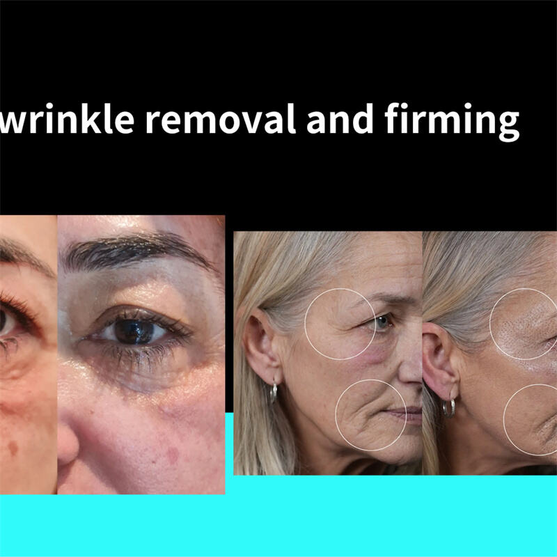 Cold Plasma Technology: Breaking Down Its Role in Reducing Fine Lines and Wrinkles