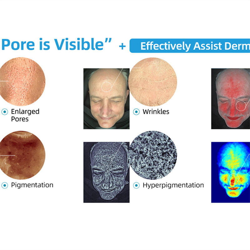 Hvad klinikker bør vide om moderne hudanalyseteknologi