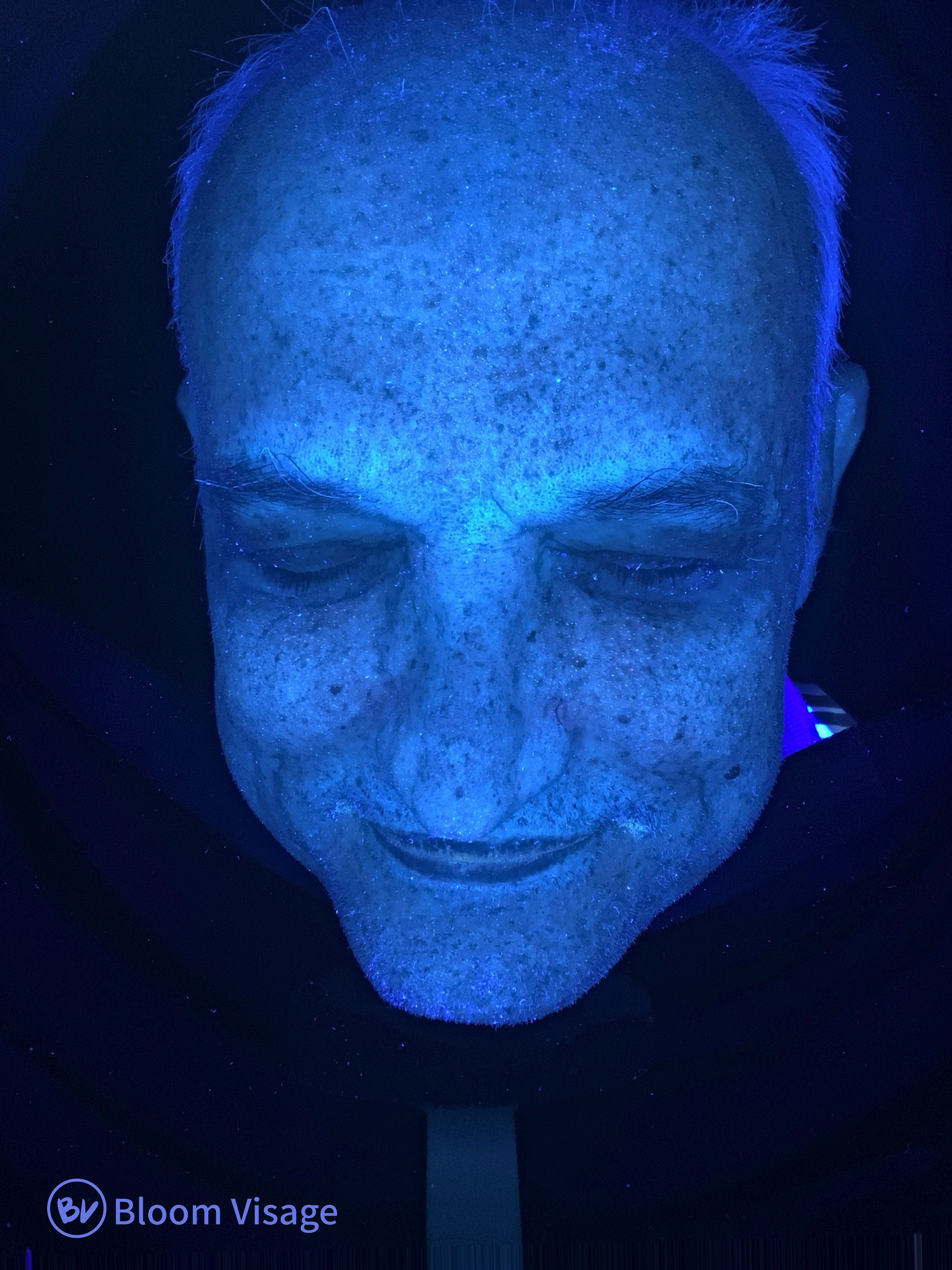 UV