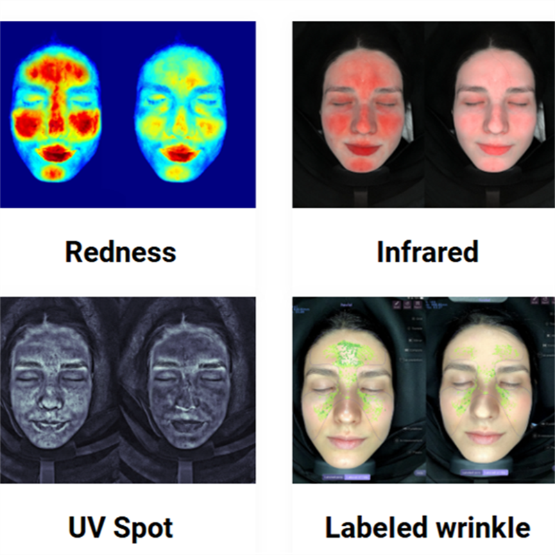 Opkomsten af AI-drevne hudanalyseapparater