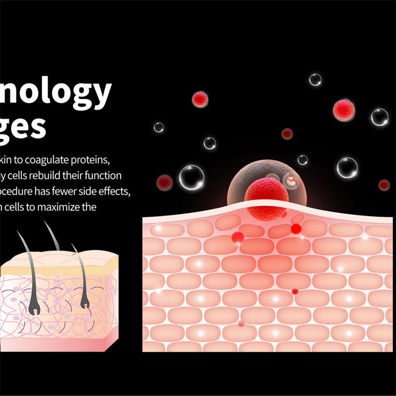 The Science of Cold Plasma in Beauty: What Makes It Effective for Skin Health