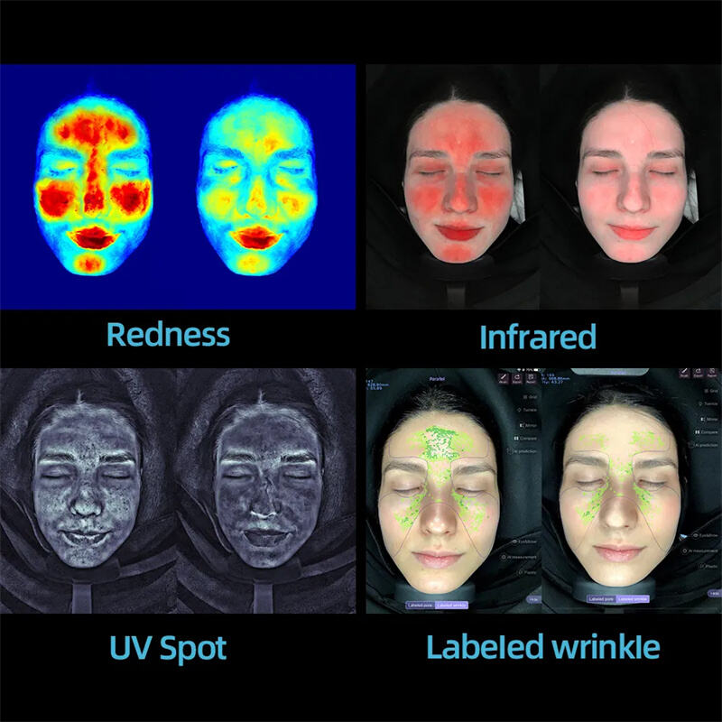 Kelebihan Utama Penganalisis Muka untuk Rantai Kecantikan