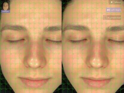 Integrering af Koldplasma Terapi i Din Skønhedskliniks Ydelser