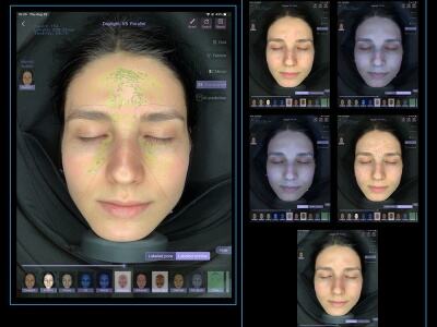 Hvad er koldplasma terapi, og hvordan gavner det din hud
