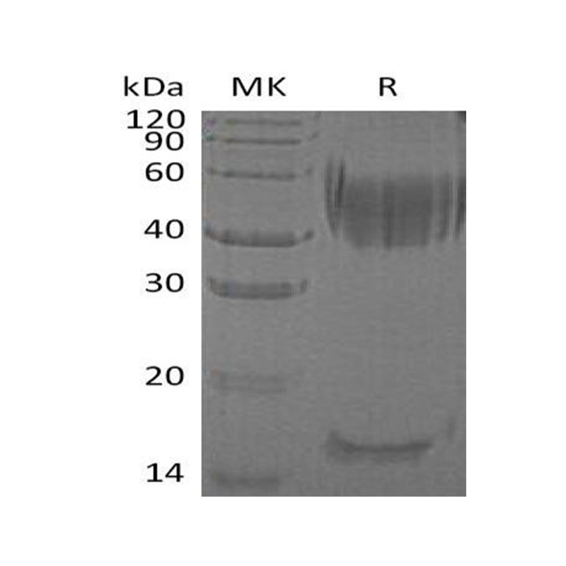 Recombinant Human Haptoglobin (C-6His)