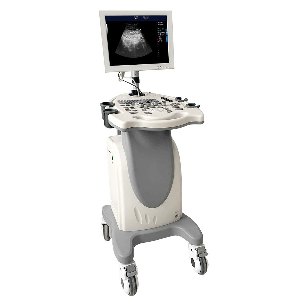Напреднала 4D ултразвукова машина за изключително визуализиране