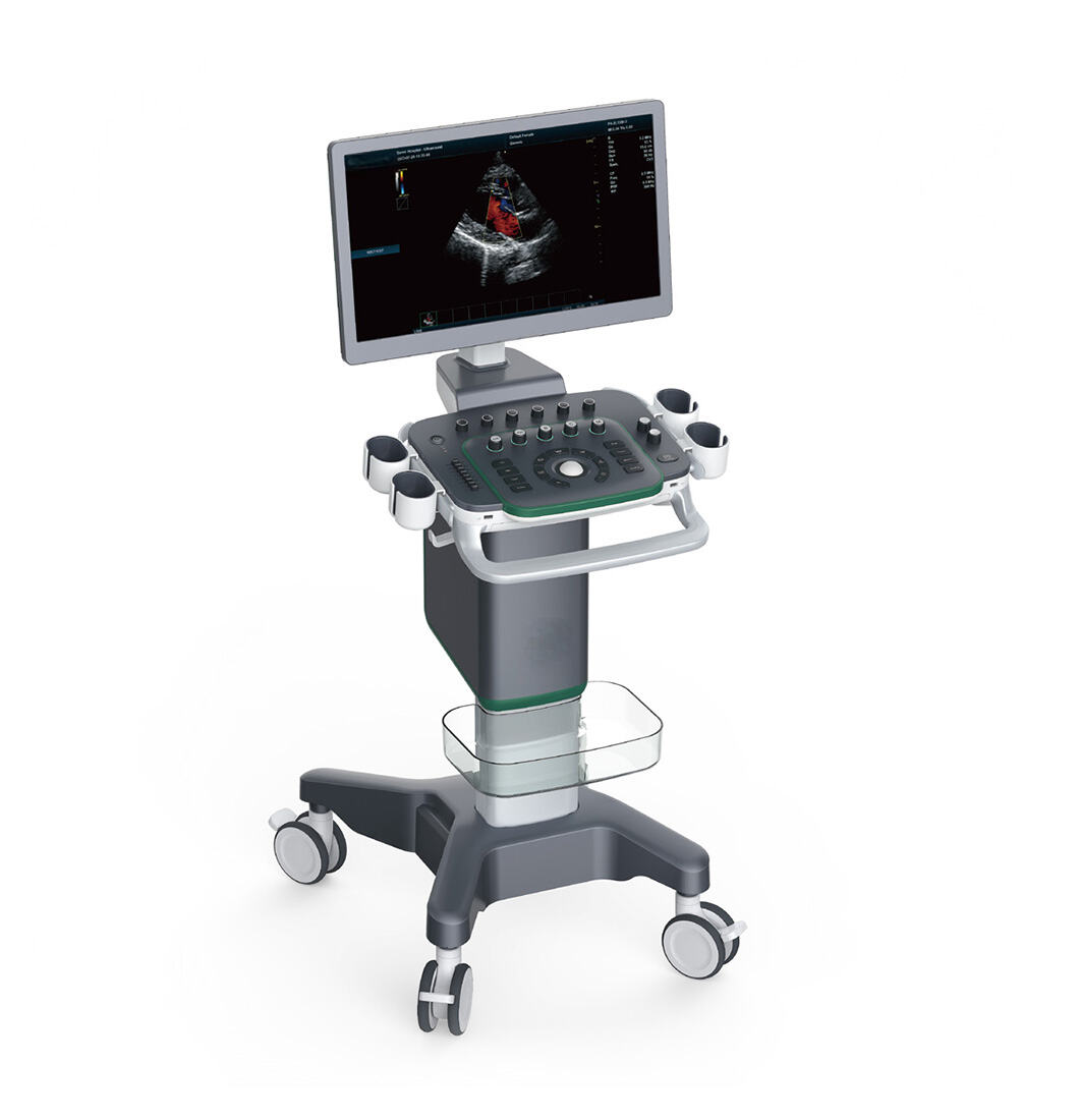 Medical User Friendly Digital Real-time Automatic Calculation Color Doppler Ultrasound