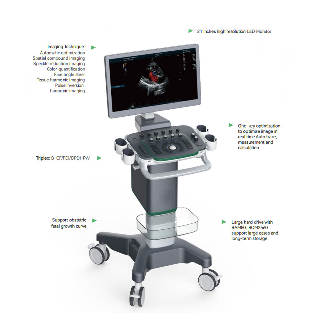 Medical User Friendly Digital Real-time Automatic Calculation Color Doppler Ultrasound