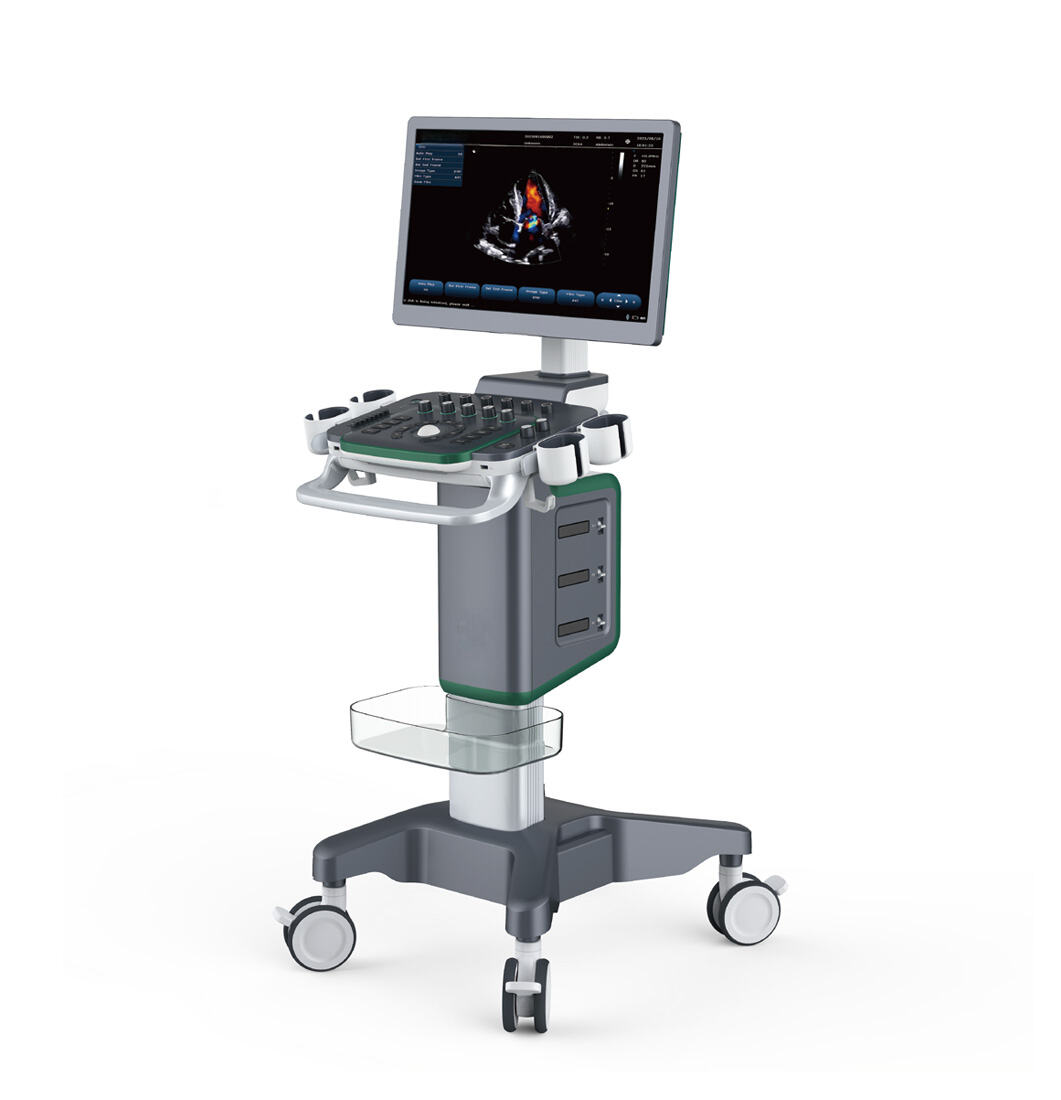 Medical User Friendly Digital Real-time Automatic Calculation Color Doppler Ultrasound