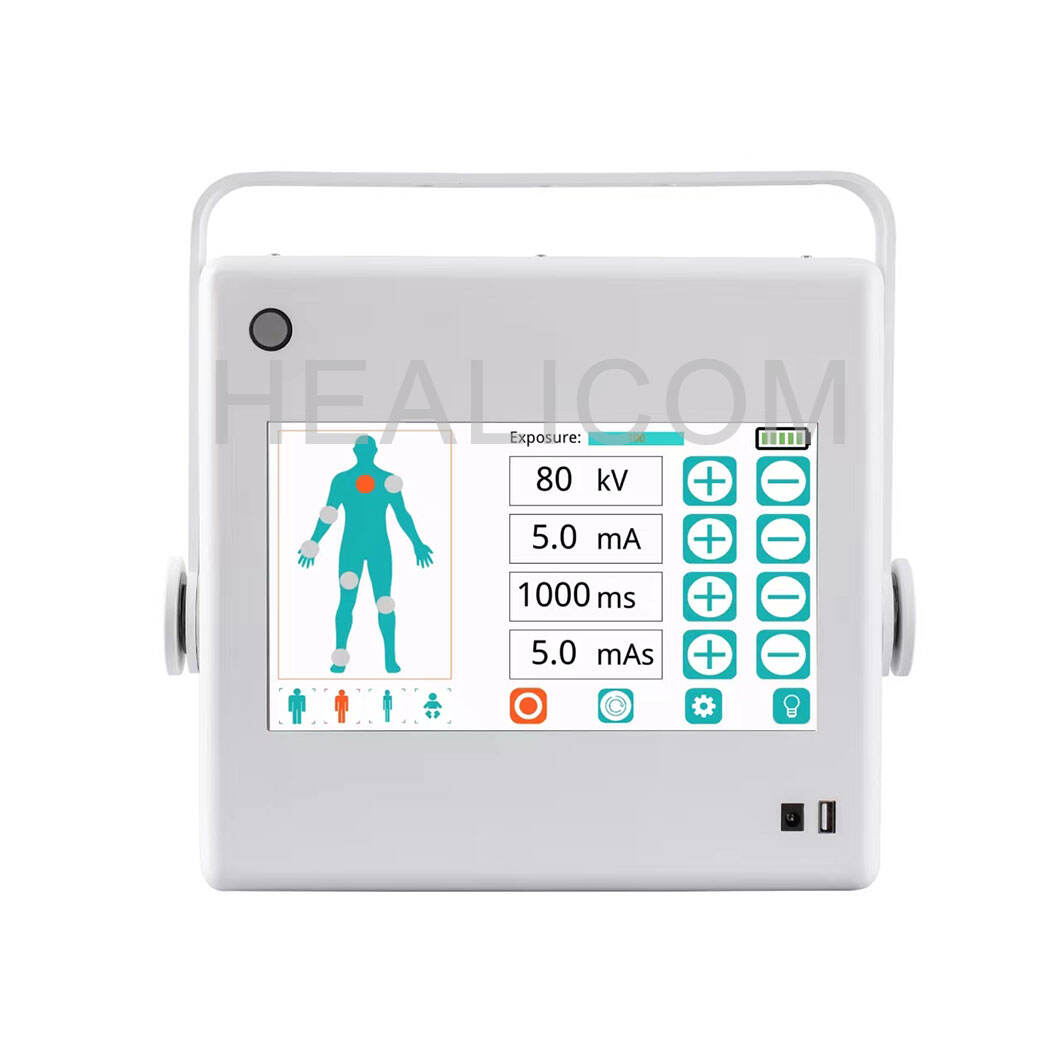 Technology Type: Digital vs. Computed Radiography and Its Impact on Xray Machine Price