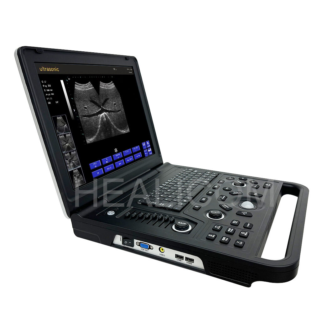 Подобрете грижите за пациентите с преносими ултразвукови решения
