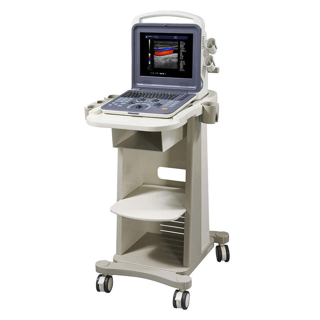 How Does Color Doppler Ultrasound Help Detect Blood Flow Abnormalities?
