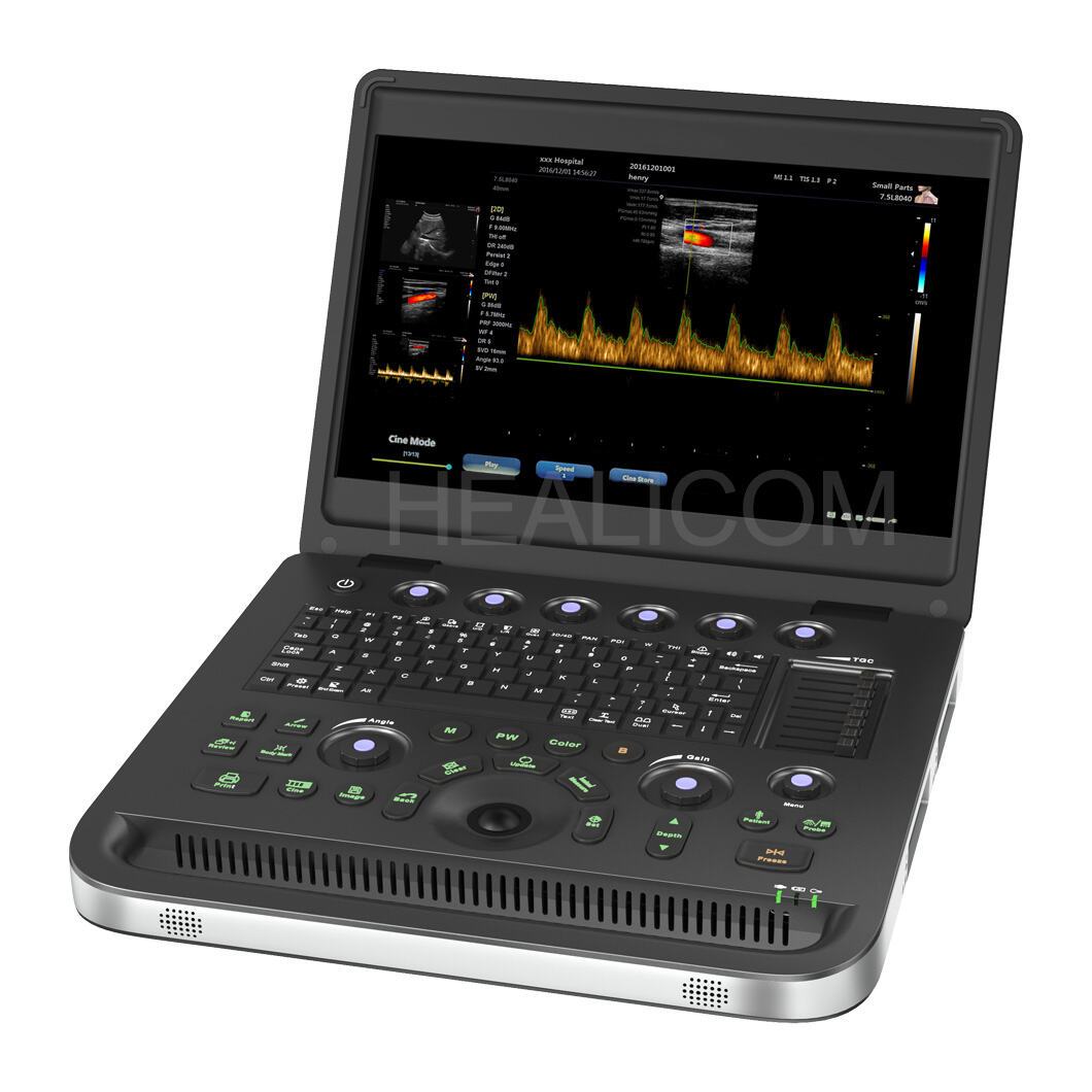 Висококачествени ултразвукови скенери от Healicom