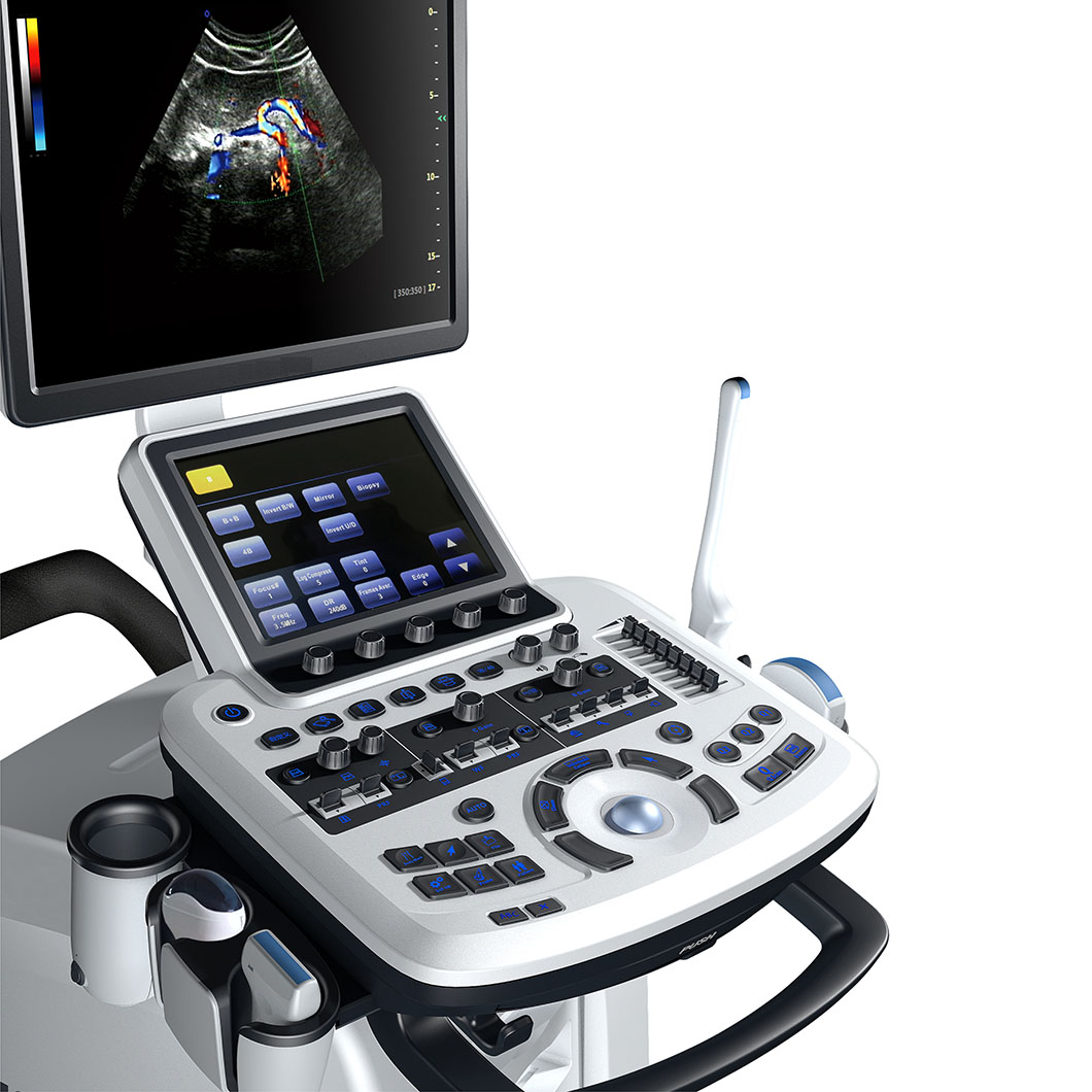 What Is the Typical 4D Ultrasound Machine Price for Maternity Clinics?
