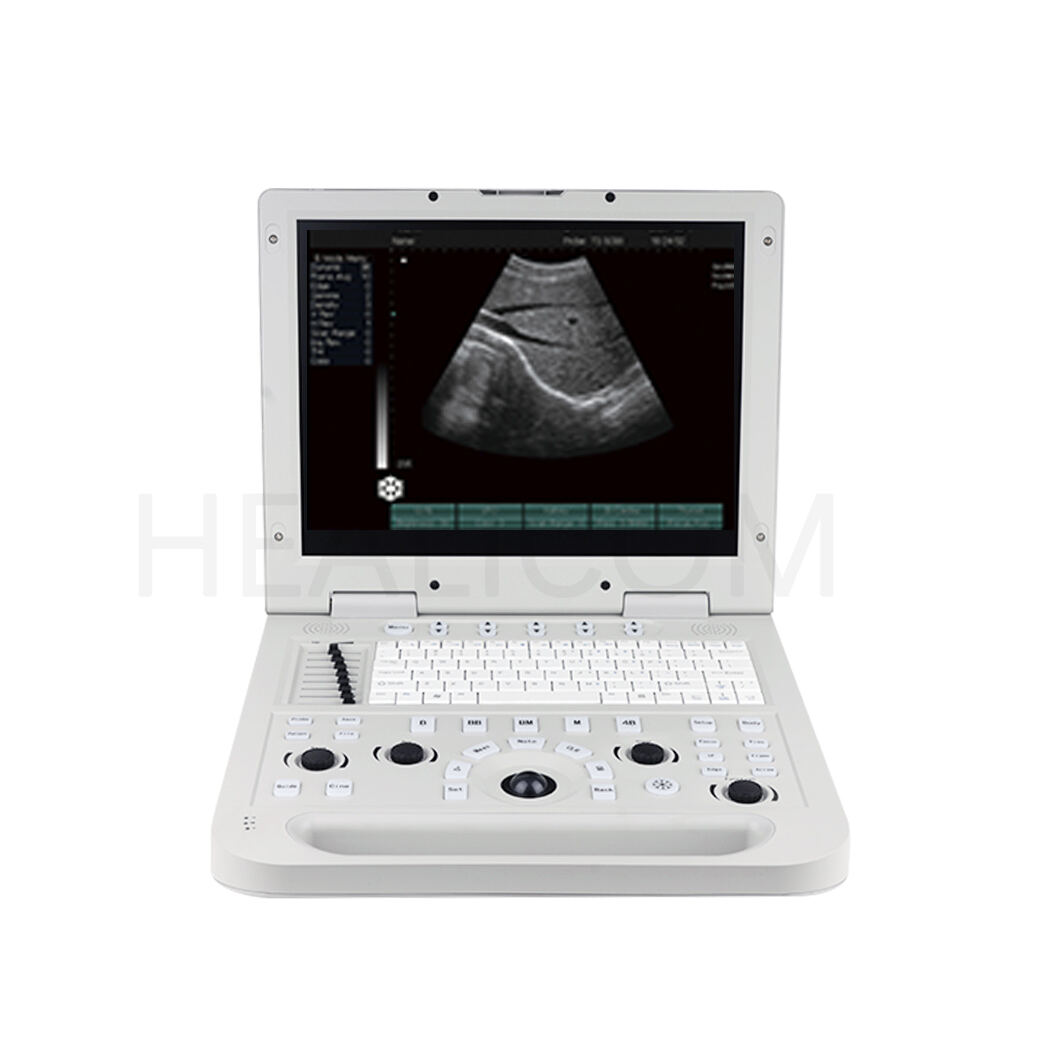Висококачествени 3D ултразвукови апарати от Healicom