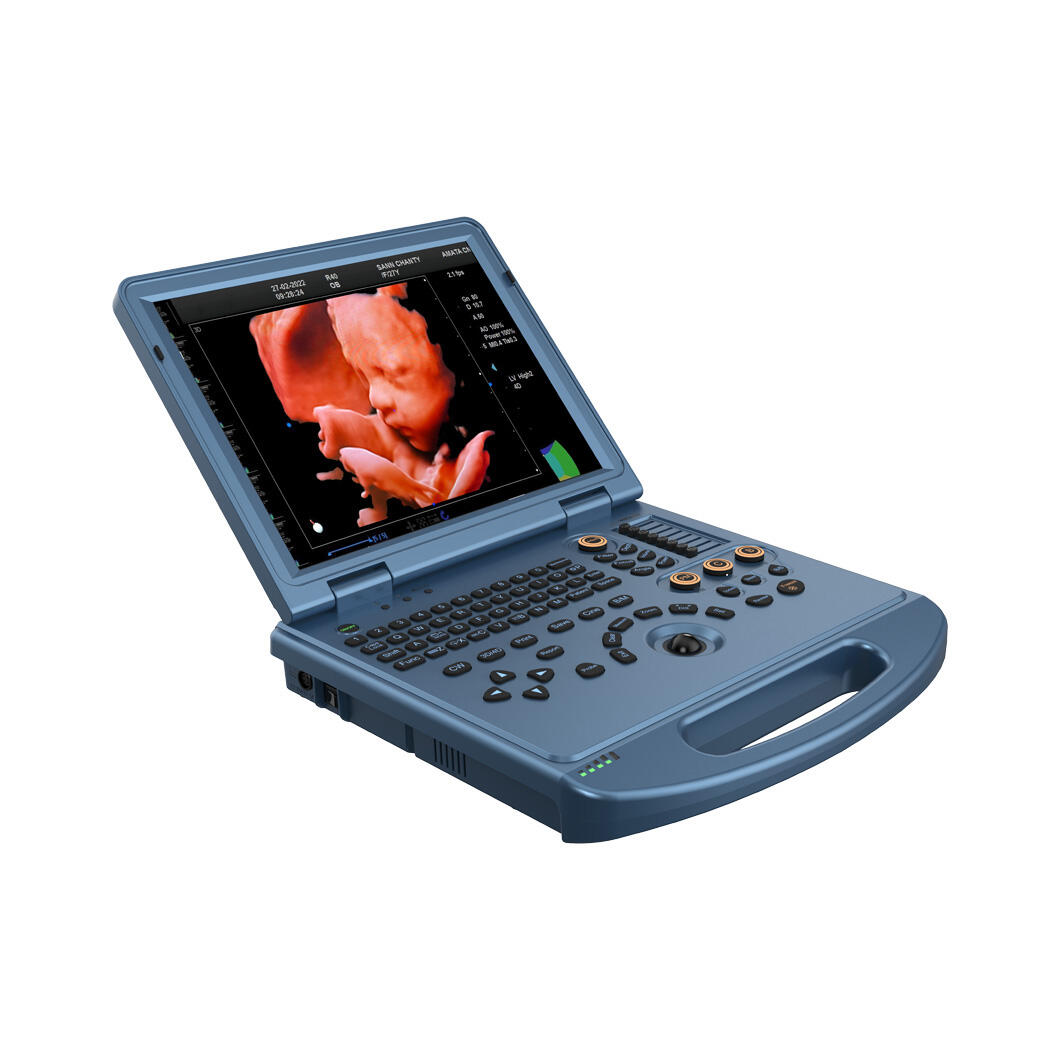 Understanding Color Doppler Ultrasound: Principles and Technology