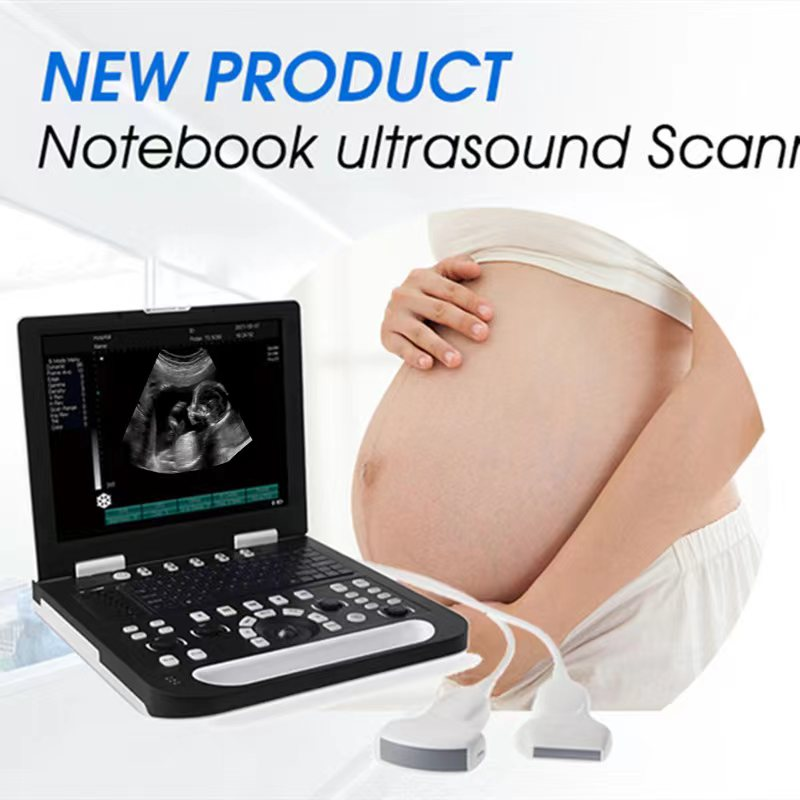 What Should Clinics Consider When Buying an Ultrasound Machine for Sale?
