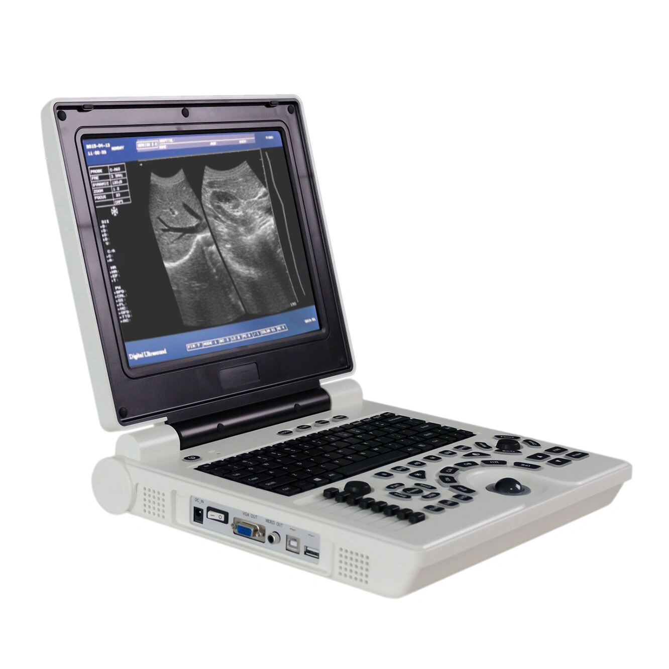 What Image Resolution Should a Portable Ultrasound Scan Machine Have?

