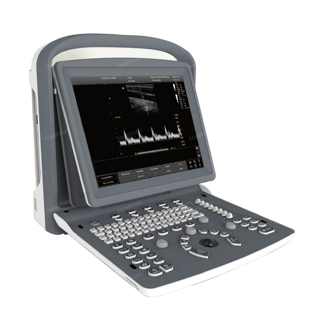 Открийте силата на ръчния ултразвук