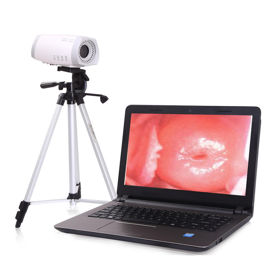 why should clinics invest in a video colposcope-1