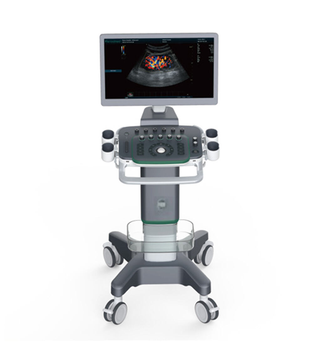 Medical User Friendly Digital Real-time Automatic Calculation Color Doppler Ultrasound