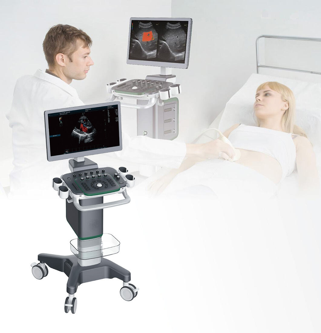 Medical User Friendly Digital Real-time Automatic Calculation Color Doppler Ultrasound