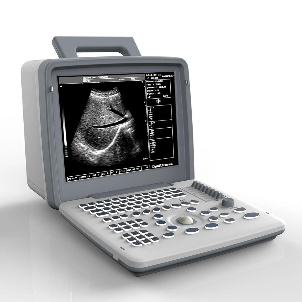 How Does a 4D Ultrasound Machine Show Real-Time Fetal Movements?

