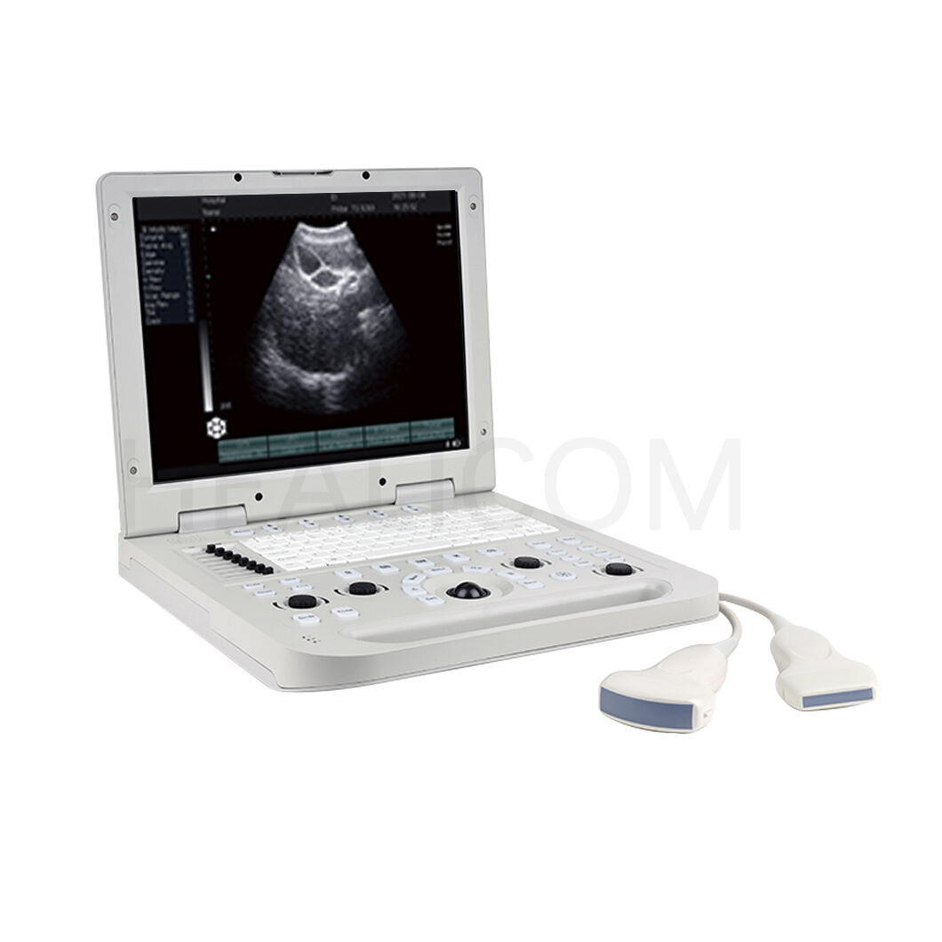 Портативна ултразвукова апаратура – висококачествено медицинско оборудване от Healicom
