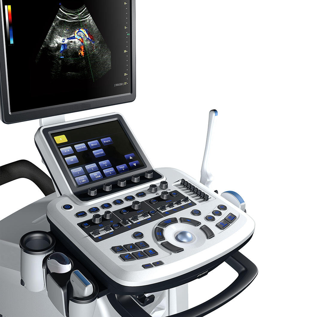 What Is a 4D Ultrasound? Real-Time Imaging in Prenatal Care