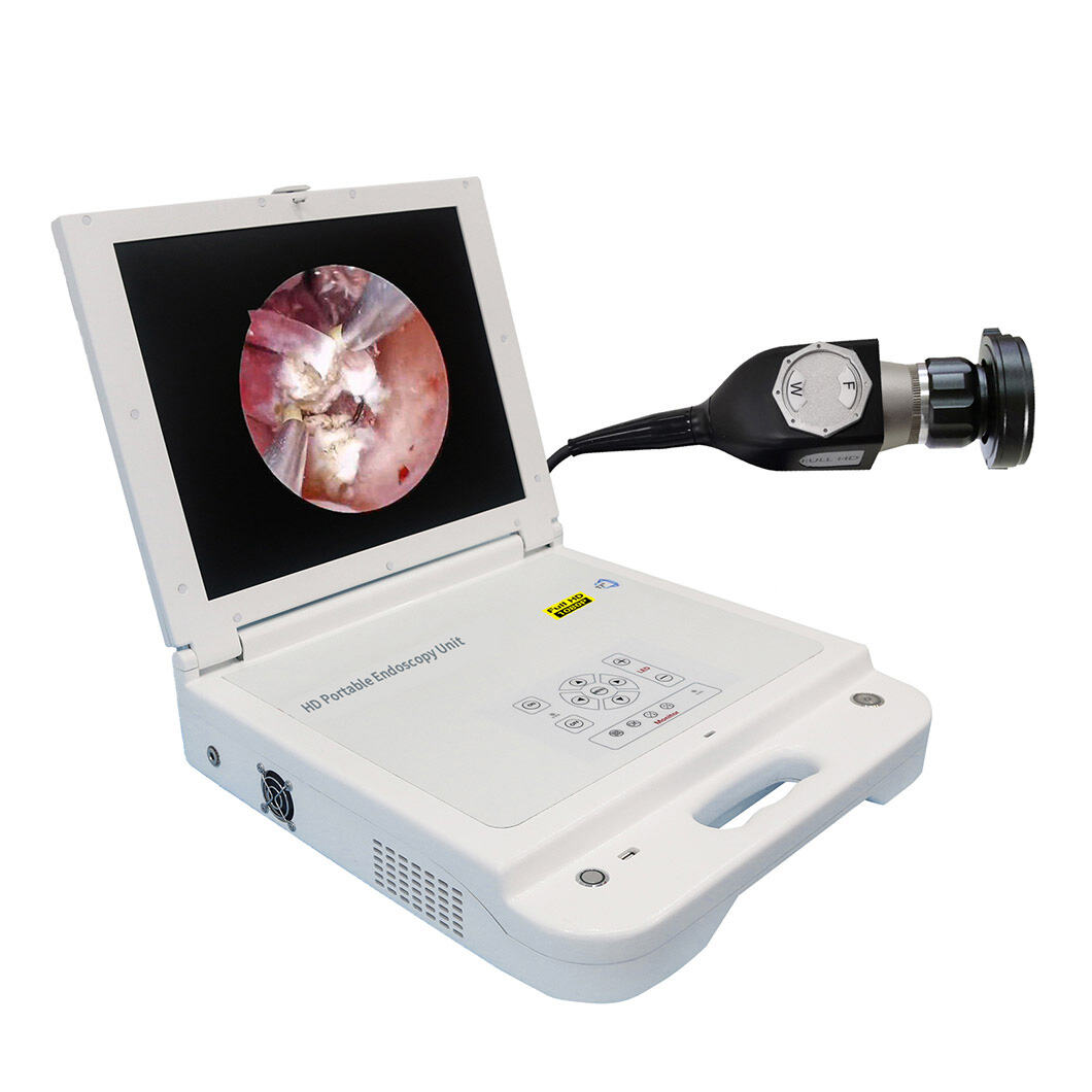 Усъвършенствана оптична технология