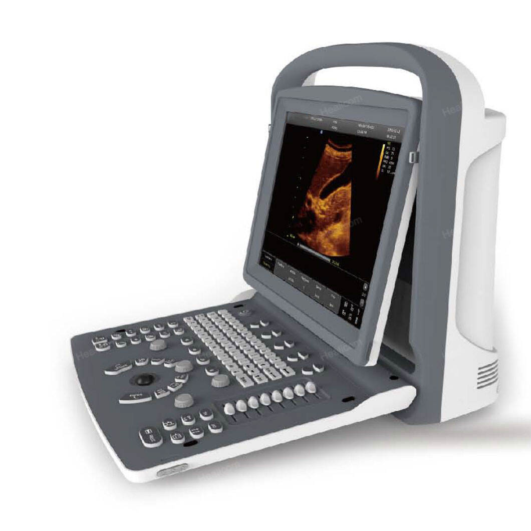 What Connectivity Features Should Portable Ultrasound Devices Have?
