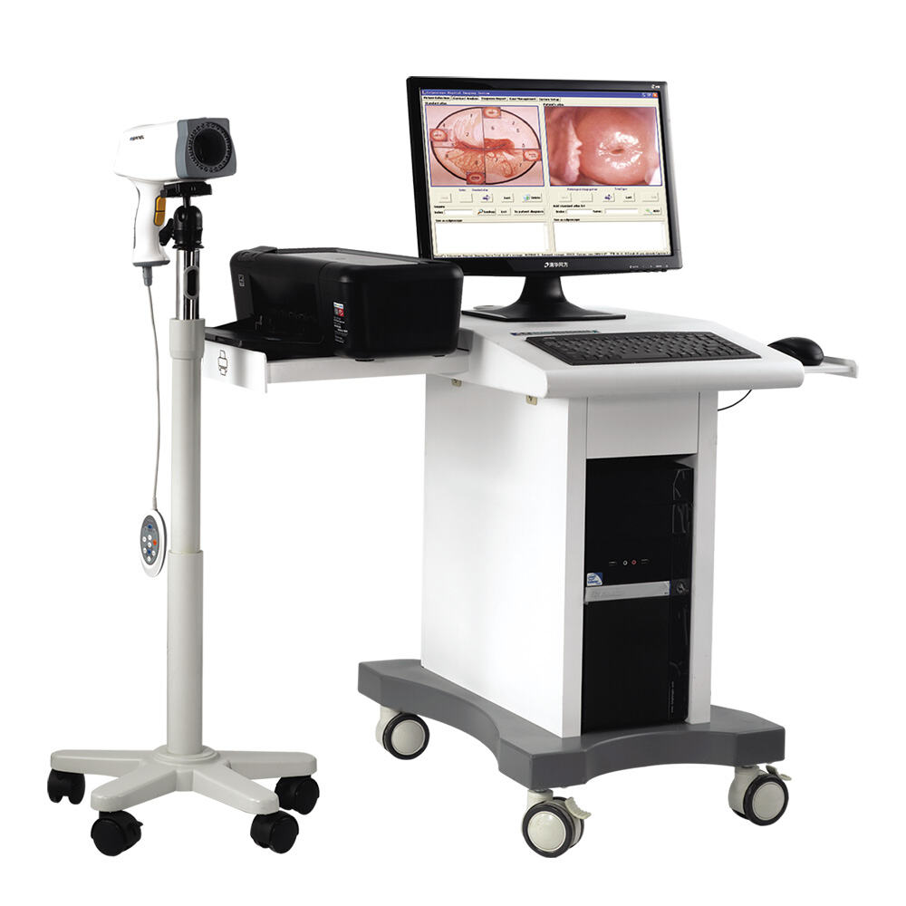Colposcope for Sale | ISO/CE-Certified Medical Grade