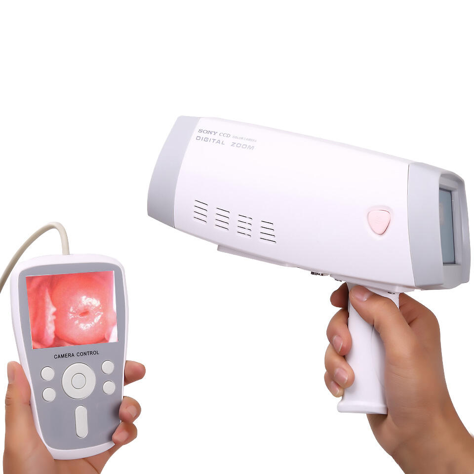 Why Should Clinics Invest in a Video Colposcope?
