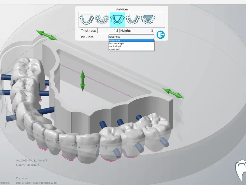 Impact Of Dental Materials On Oral Health: What You Should Know