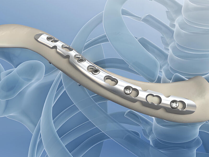 TA2/GR2 टाइटेनियम प्लेट और रॉड: संक्षारण प्रतिरोध और हल्के वजन वाले इंजीनियरिंग के लिए बहुमुखी शुद्ध टाइटेनियम