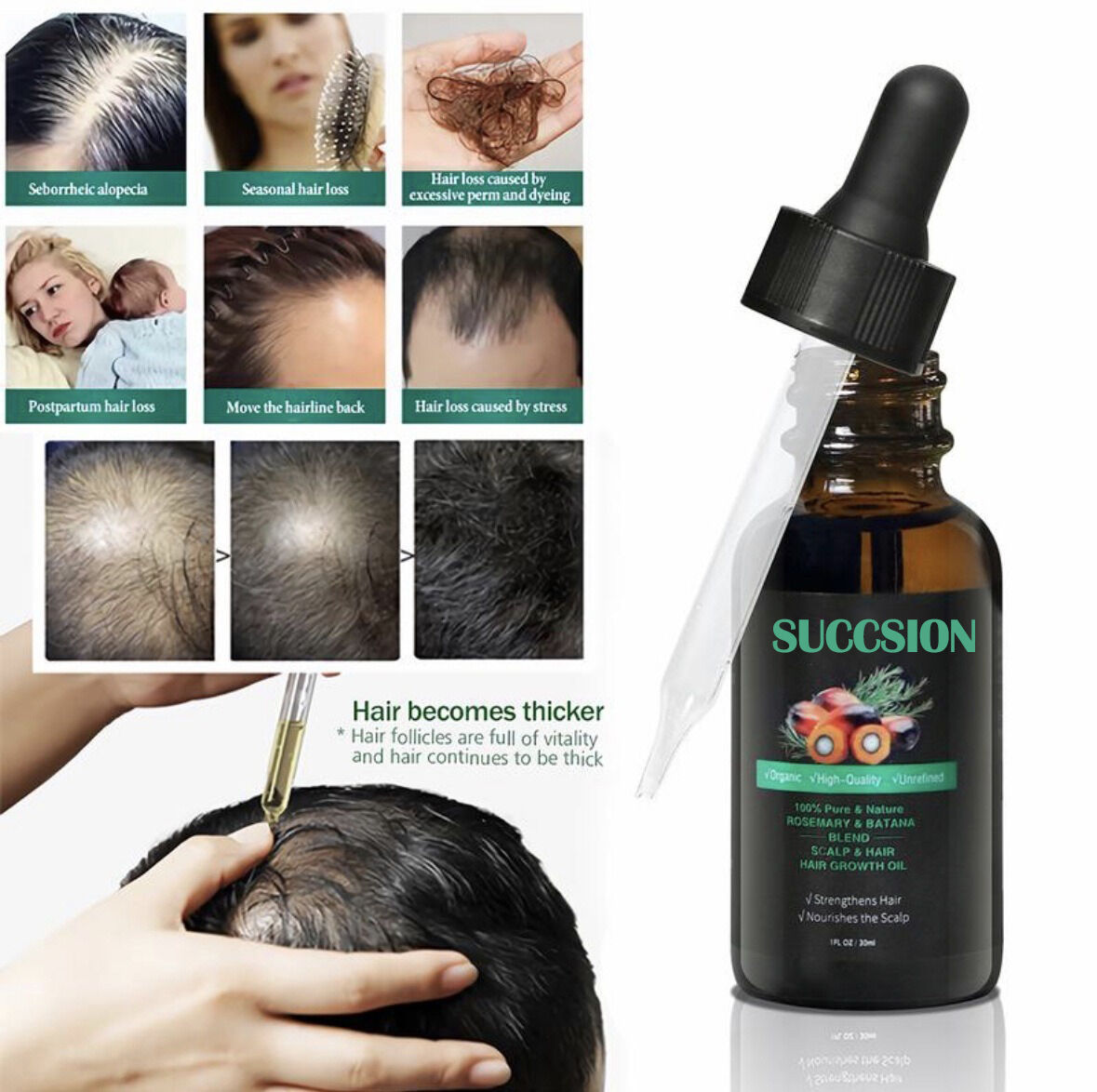 Verfris Jou Haarlyn en Groei Jou Haar Opnieu Uit met Rysolie – Natuurlik en Ekonomies!