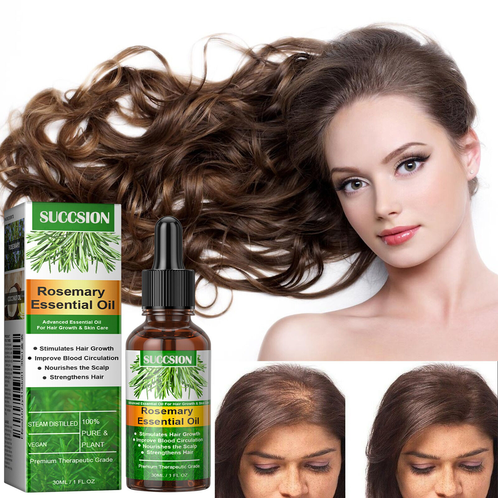 How rosemary oil is a game-changer for hair