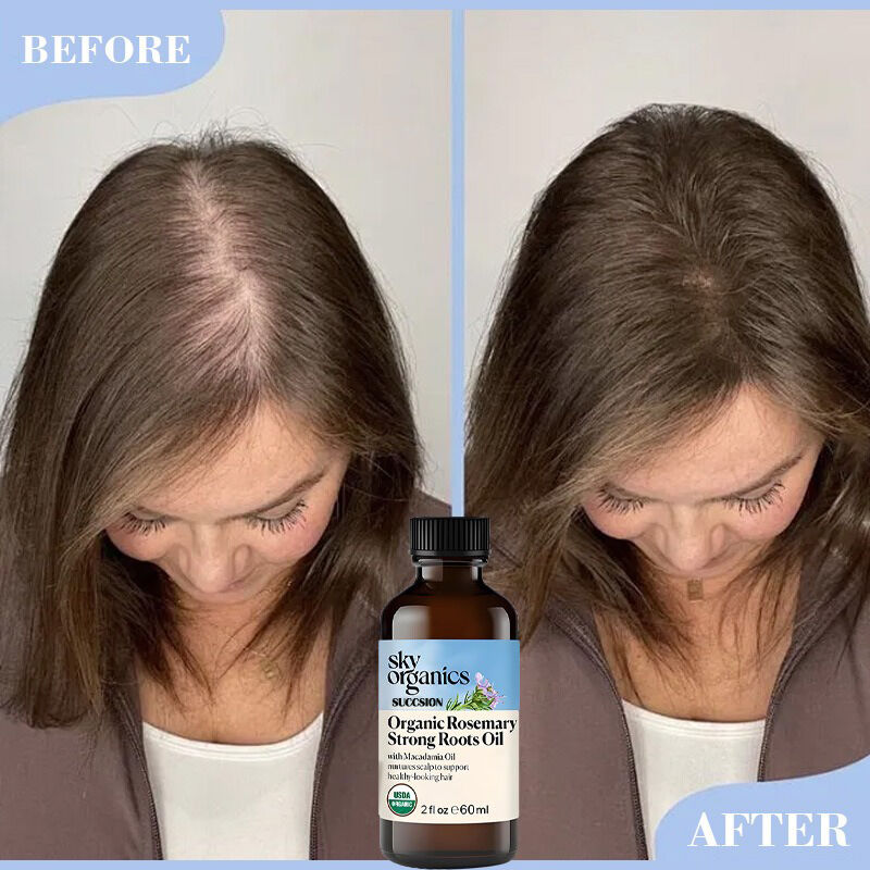 Revitalize your scalp with the natural powers of tea tree