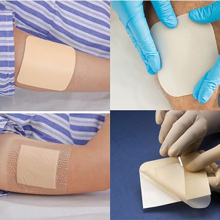 Advanced wound dressing