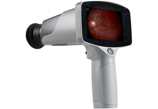 Ophthalmic Retinal Camera Non-mydriatic Fundus Camera
