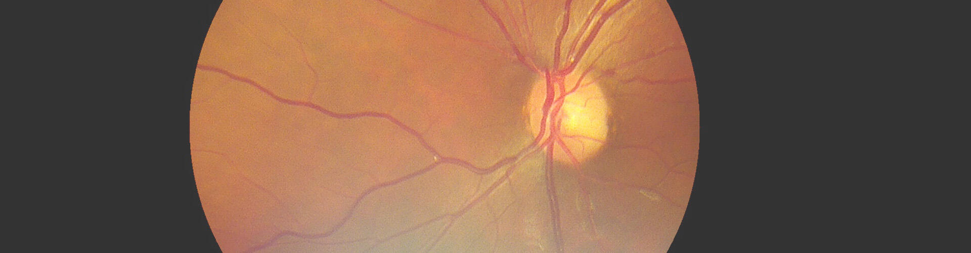 fundus camera-1