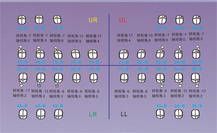 Chinese Dental Valley Feiya V-Smile The eigth generatiupper of passive ...