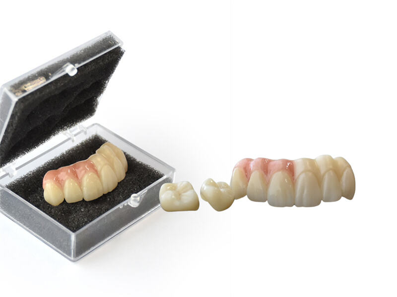 6 units bridge, made of 4D X ML zirconia block.jpg