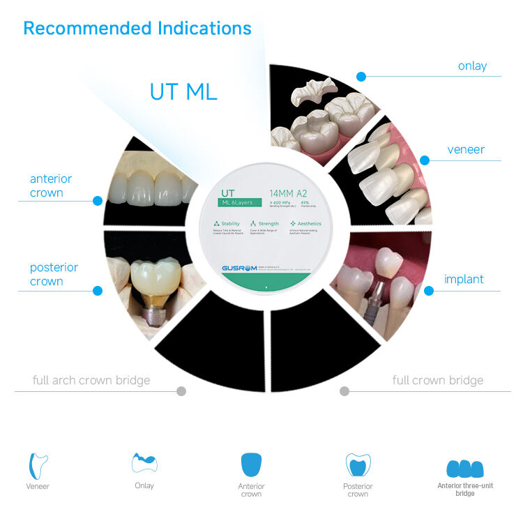 4-Ultra Translucent Zirconia Multilayer Indications.jpg