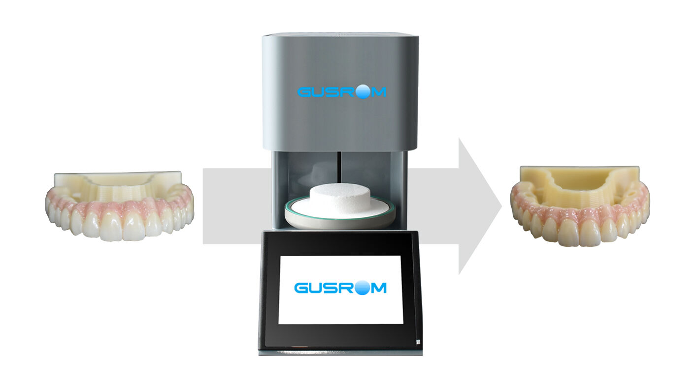 4d x ml  the ideal restoration choice in the digital dentistry era-4