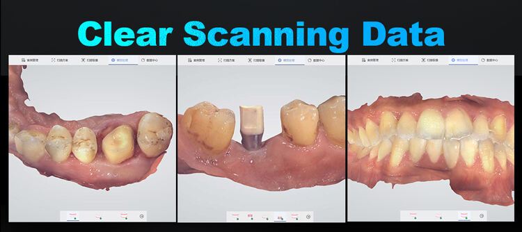 8-Super Clear Scanning Data.jpg