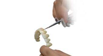 4d x ml  the ideal restoration choice in the digital dentistry era-3