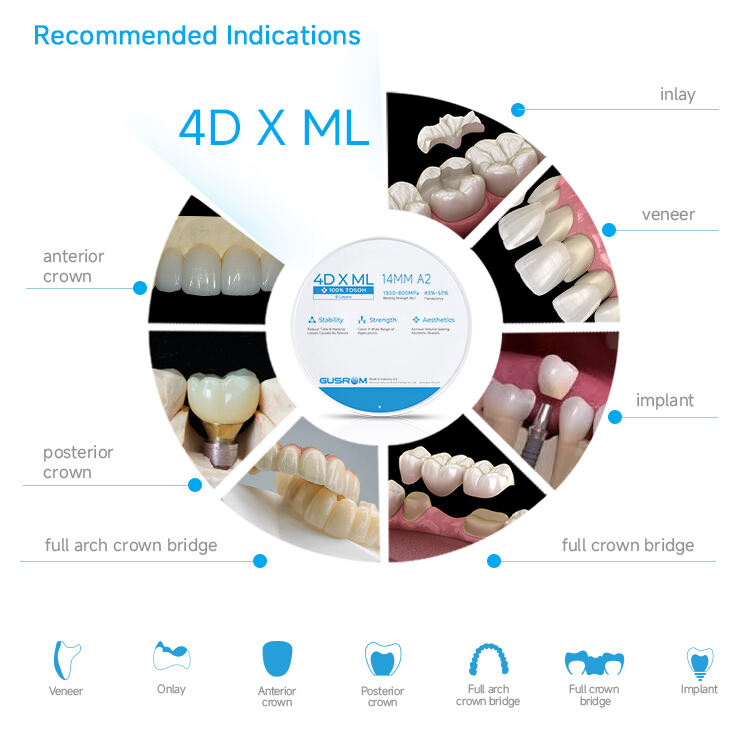详情-4D-X-ML_04.jpg